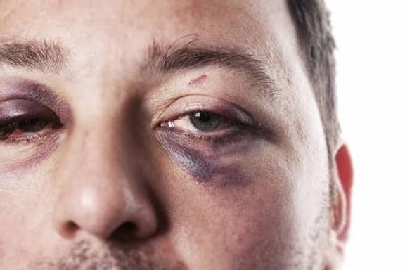 eye injury treatment