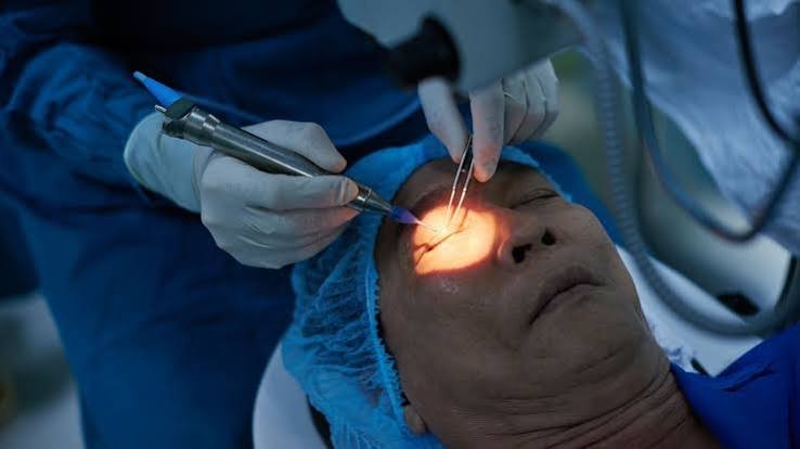 glaucoma treatment