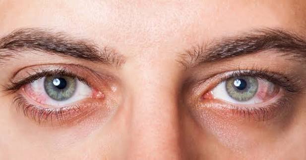 hypertensive eye disease