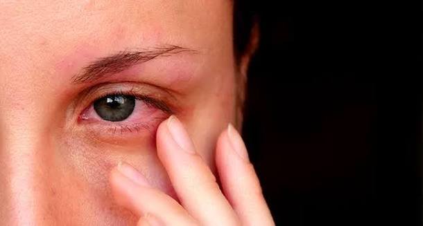 watery eyes treatment
